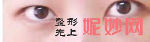 北京丽眼国际去眼袋机构(北京站店)口碑好不好？内含价格表以优秀案例