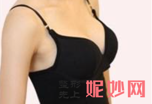 广州自体脂肪隆胸哪家医院好？内附价格表以及案例展示