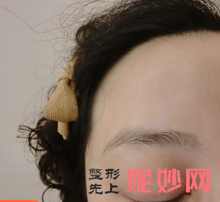 北京八大处面部除皱专家：赵延勇和杨欣谁做面部除皱口碑反馈效果好