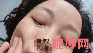 北京八大处面部除皱专家：赵延勇和杨欣谁做面部除皱口碑反馈效果好