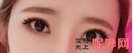 长沙眼综合哪个专家较好？眼综合价格如何？