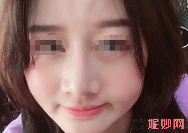 上海九院面部脂肪填充哪个专家好？附案例分析及价格表！