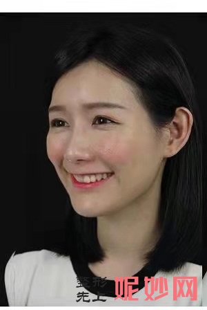 武汉小忠丽格李莎怎么样？内含价格表及案例分析