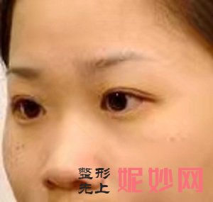 武汉小忠丽格李莎怎么样？内含价格表及案例分析