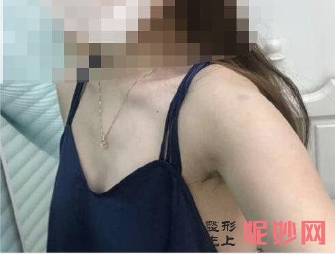 北京八大处较好的丰胸专家是谁？附案例分析及价格表！