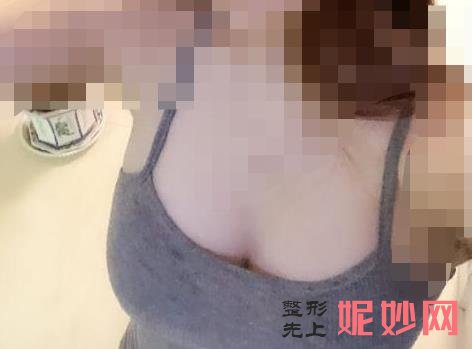 北京八大处较好的丰胸专家是谁？附案例分析及价格表！