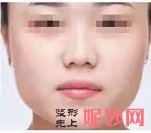 北京小忠丽格唐静医生怎么样？内含价格表及案例分析