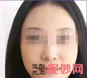 北京小忠丽格唐静医生怎么样？内含价格表及案例分析