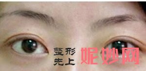 小忠丽格赵小忠怎么样？内含价格表及案例分析