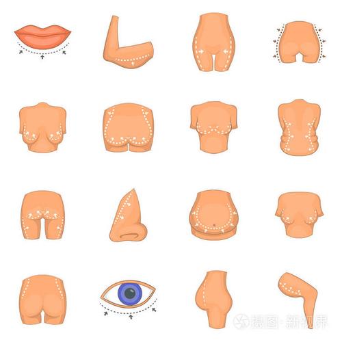 北京圣嘉荣周松怎么样？隆鼻口碑案例及价格表参考！