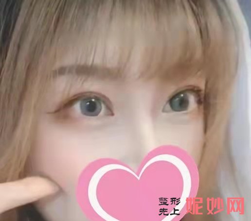 深圳春天阳光整形美容怎么样？附案例分析和价格表