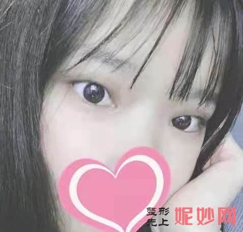 深圳春天阳光整形美容怎么样？附案例分析和价格表