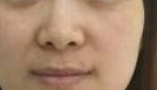 广州军美医疗美容怎么样？附案例分析和价格表