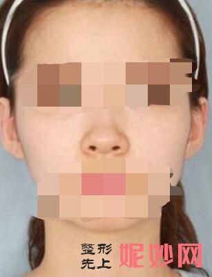 广州鹏爱医疗美容怎么样？内附案例