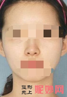 广州鹏爱医疗美容怎么样？内附案例