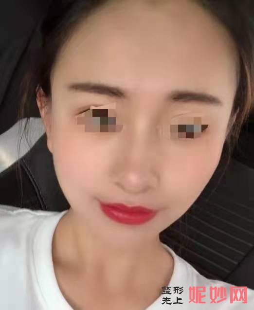 成都晶肤医疗美容连锁怎么样？附法案例分析和价格表