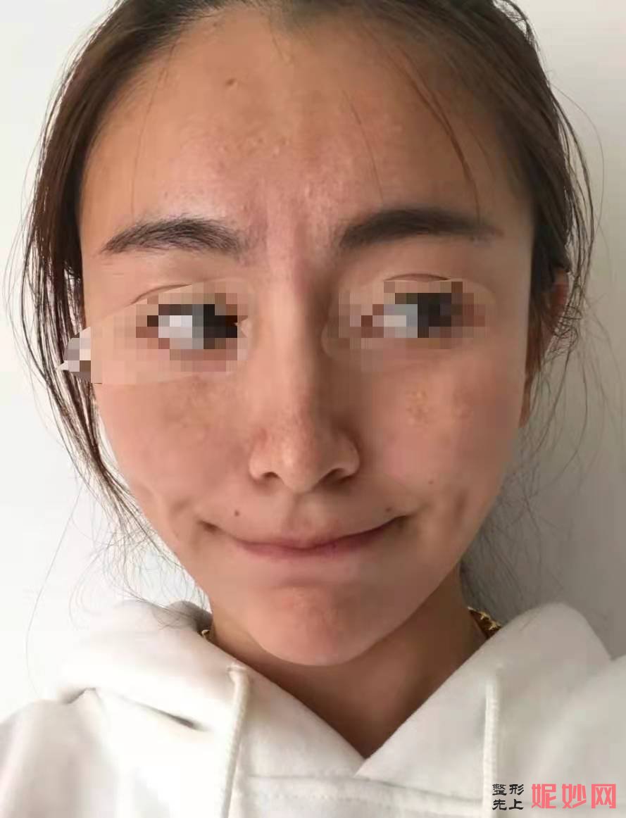 成都晶肤医疗美容连锁怎么样？附法案例分析和价格表