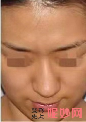 四川悦好医学美容医院口碑好不好？内含价格表及案例分析