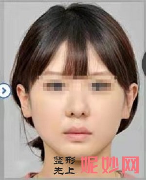 四川悦好医学美容医院口碑好不好？内含价格表及案例分析