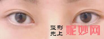 武汉美莱怎么样？内附案例