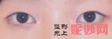 武汉美莱怎么样？内附案例