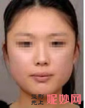 武汉艺龄医疗美容医院怎么样？内含价格表及案例分析