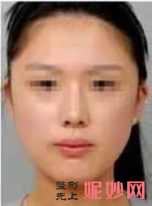 武汉艺龄医疗美容医院怎么样？内含价格表及案例分析