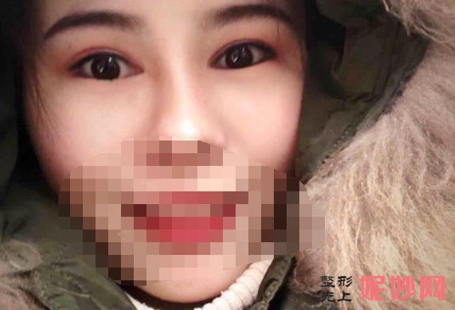 重庆铂生医疗美容医院能做双眼皮吗？医院介绍附双眼皮案例和价格表！