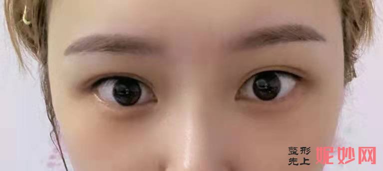 武汉硚口卓美医疗美容门诊部怎么样？附案例分析和价格表