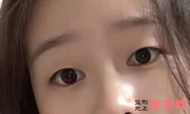 南京美莱医疗美容医院怎么样？附案例分析和价格表