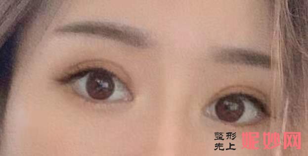 南京美莱医疗美容医院怎么样？附案例分析和价格表