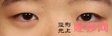 成都军大整形美容医院怎么样？内附价格表及案例