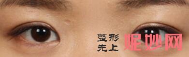 成都军大整形美容医院怎么样？内附价格表及案例