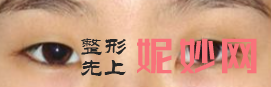 昆明美伊莱整形医院怎么样？内附价格表及案例