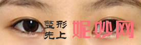 昆明美伊莱整形医院怎么样？内附价格表及案例
