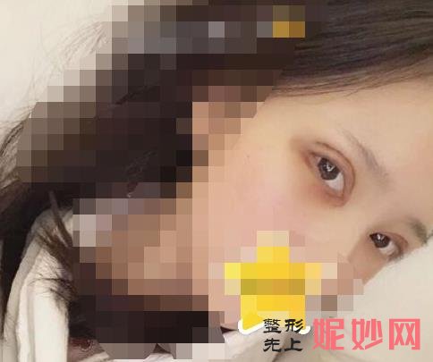 南京医科大学友谊整形外科医院好吗？能做双眼皮吗？附双眼皮案例和价格表！