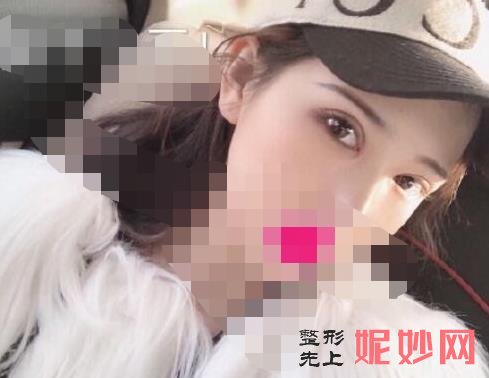南京医科大学友谊整形外科医院好吗？能做双眼皮吗？附双眼皮案例和价格表！