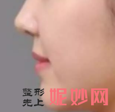 西安华旗唯美整形医院怎么样？内附案例及价格表