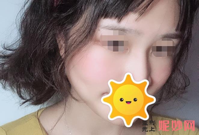 长沙爱思特医疗美容医院怎么样？能做激光祛皱吗？医院介绍妇激光祛皱案例和价格表！