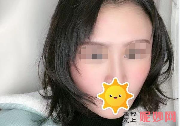 长沙爱思特医疗美容医院怎么样？能做激光祛皱吗？医院介绍妇激光祛皱案例和价格表！