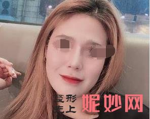 南京连天美美容医院怎么样？能做激光祛斑吗？附激光祛斑案例和价格表！