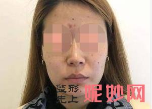 南京连天美美容医院怎么样？能做激光祛斑吗？附激光祛斑案例和价格表！