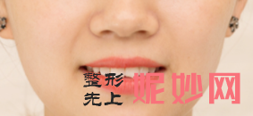 南京华美美容医院怎么样？内附案例及价格表