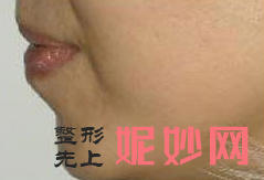 南宁科之美整形医院怎么样？内附案例及价格表