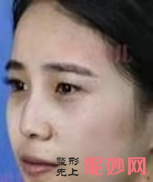 北京东方和谐常双明怎么样？内含价格表及案例分析