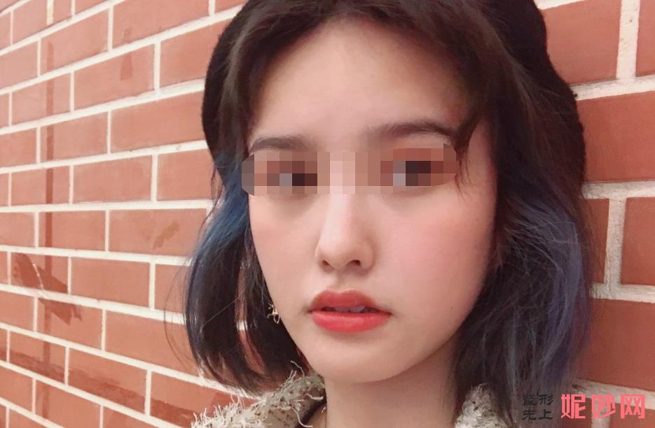 西安画美医疗美容医院能做玻尿酸填充吗？附玻尿酸填充案例和价格表！