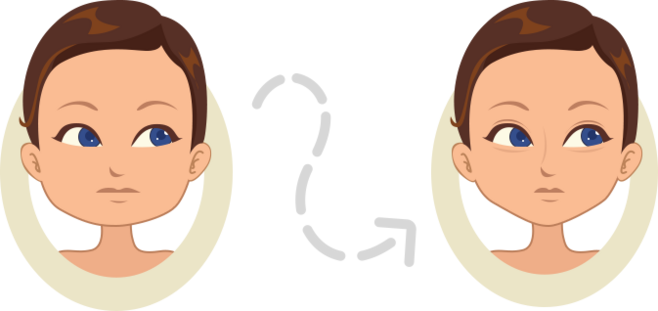 上海九院谢峰有吸脂失败案例吗？谢峰吸脂技术如何|价格表