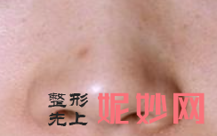 广西南宁达美整形医院怎么样？内附案例和价格表