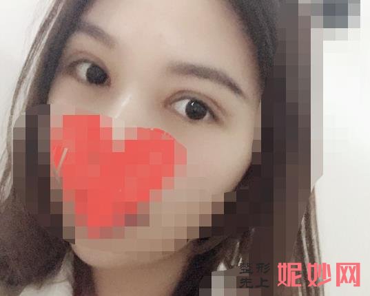 西安亚太医疗整形医院做双眼皮修复好吗？医院介绍附案例和价格表！