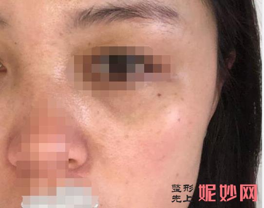 西安晶肤医疗美容医院做祛斑好不好？医院介绍附祛斑案例和价格表！